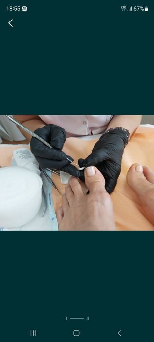 PODOLOG MOBILNY  Rataje  CAŁY POZNAŃ dla Seniorów Dojaz Pedicure