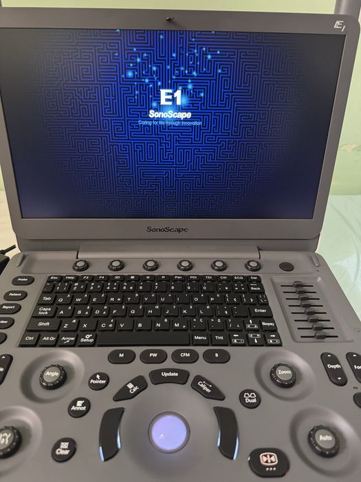 Новий ультразвуковий апарат Sonoscape E1 з 2ма датчиками УЗД