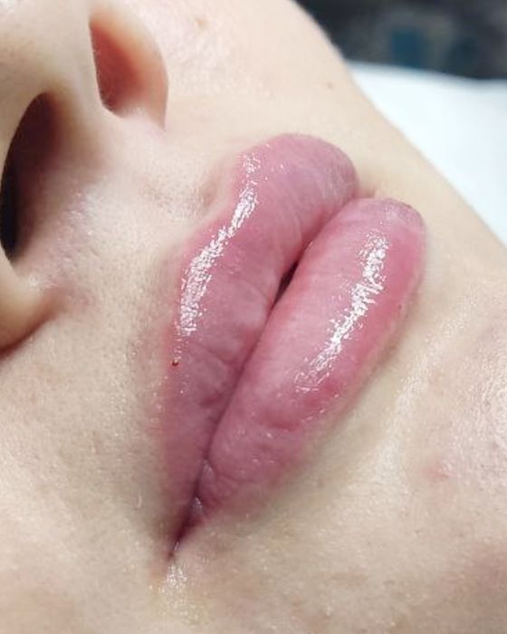 Косметолог | Київ, Позняки