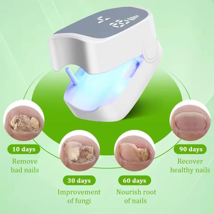 Dispositivo profissional UV de limpeza/tratamento de fungos nas unhas