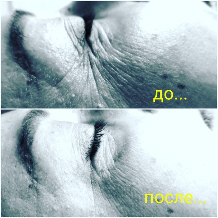 Масаж міоліфтинговий обличчя, антицелюлітний, розслабляючий.