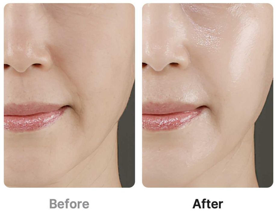 [Medicube] Age-R Booster Pro purple