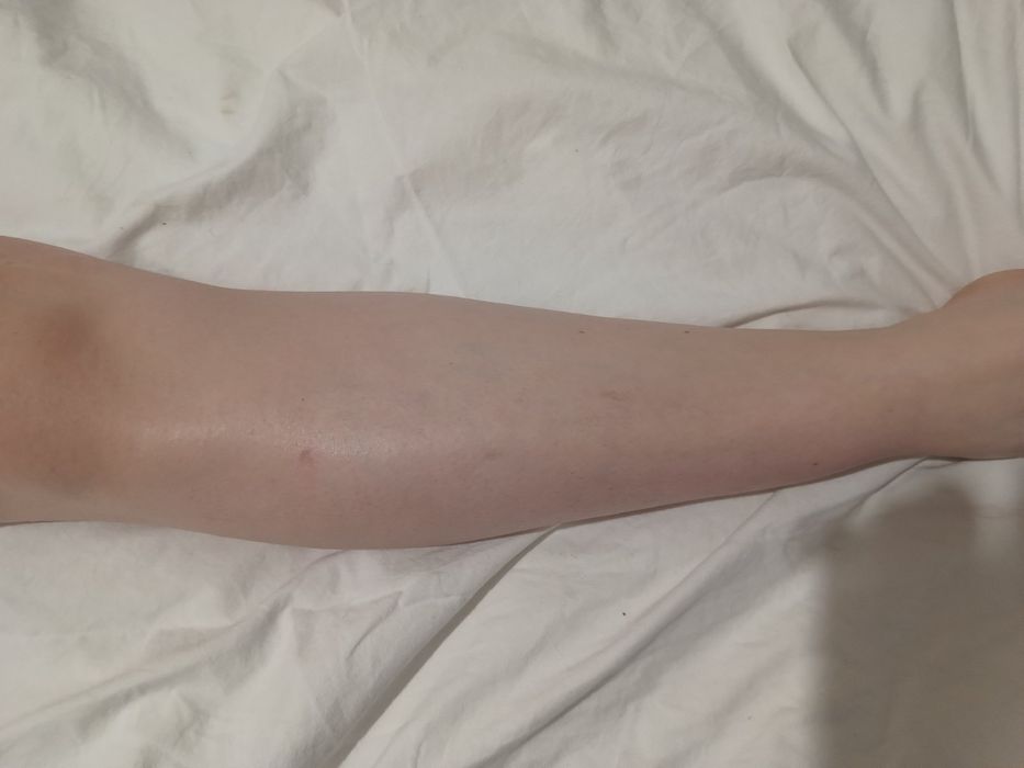 Знижка на Масаж на все тіло , урологічний, депіляція для чоловіка та ж