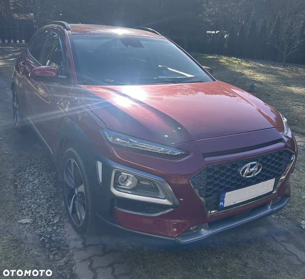 Hyundai Kona 1.6 CRDi DCT Premium - 1