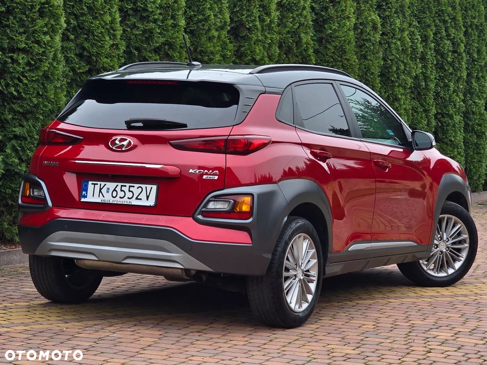 Hyundai Kona 2018 photo 2
