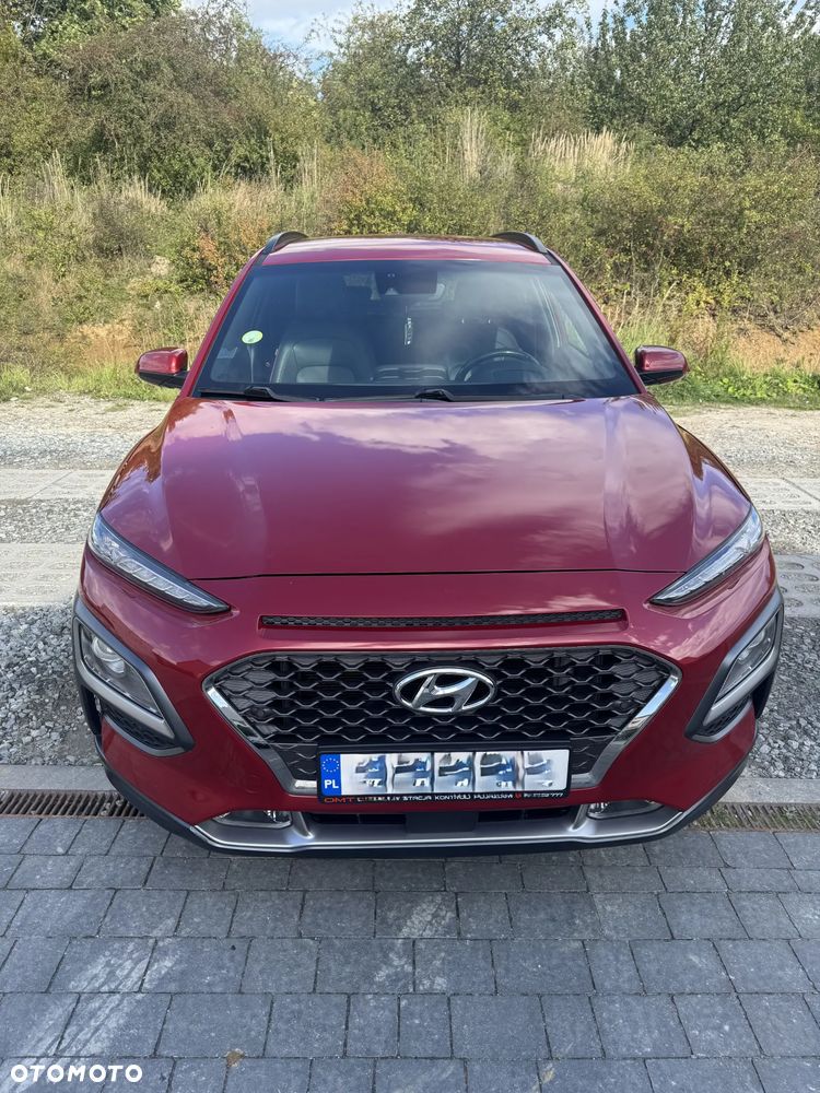 Hyundai Kona 1.6 CRDi Style DCT - 2