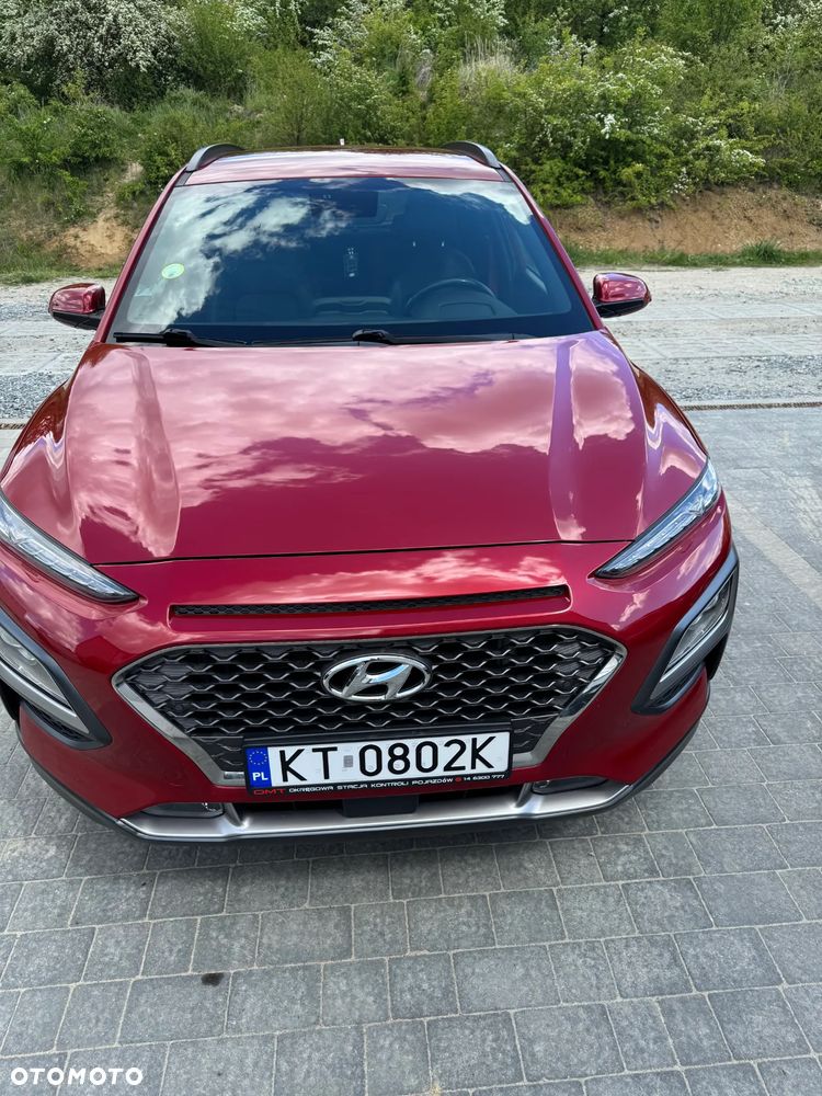 Hyundai Kona 1.6 CRDi DCT Premium - 3