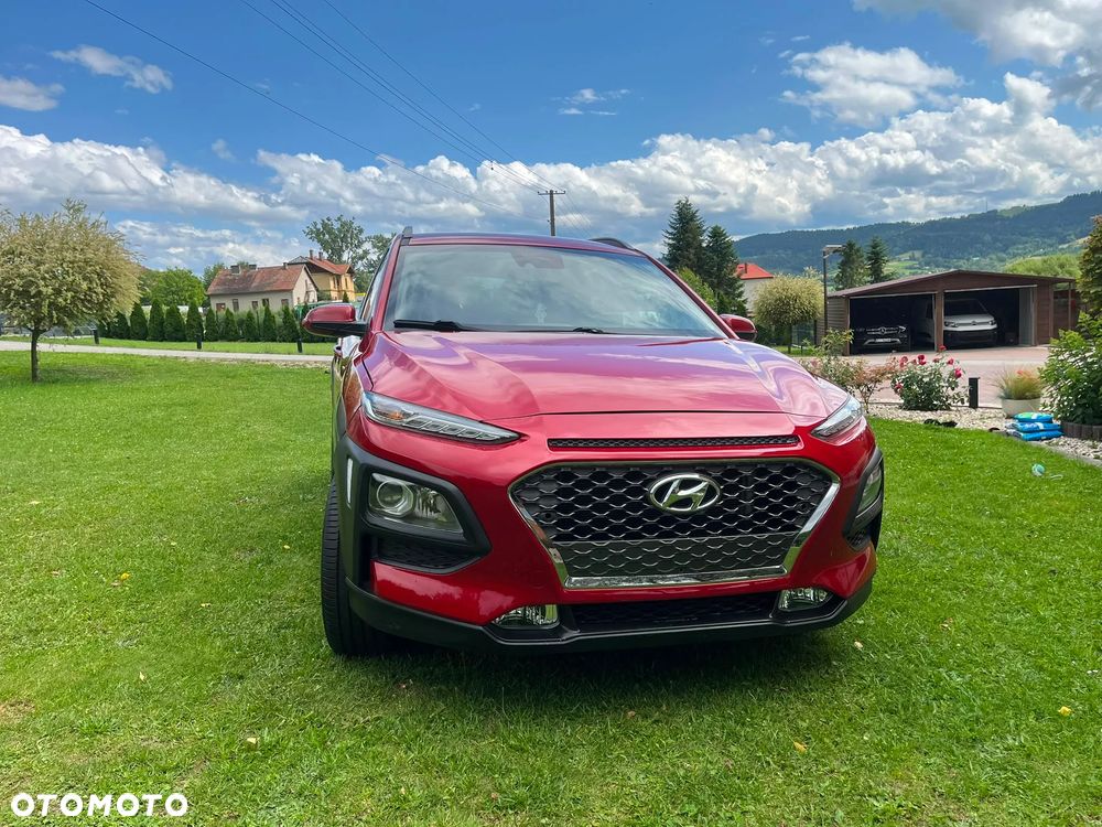 Hyundai Kona 1.6 CRDi DCT Premium - 21