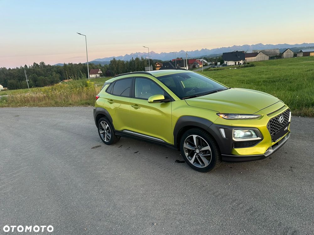Hyundai Kona 1.6 T-GDI DCT 4WD Premium - 5
