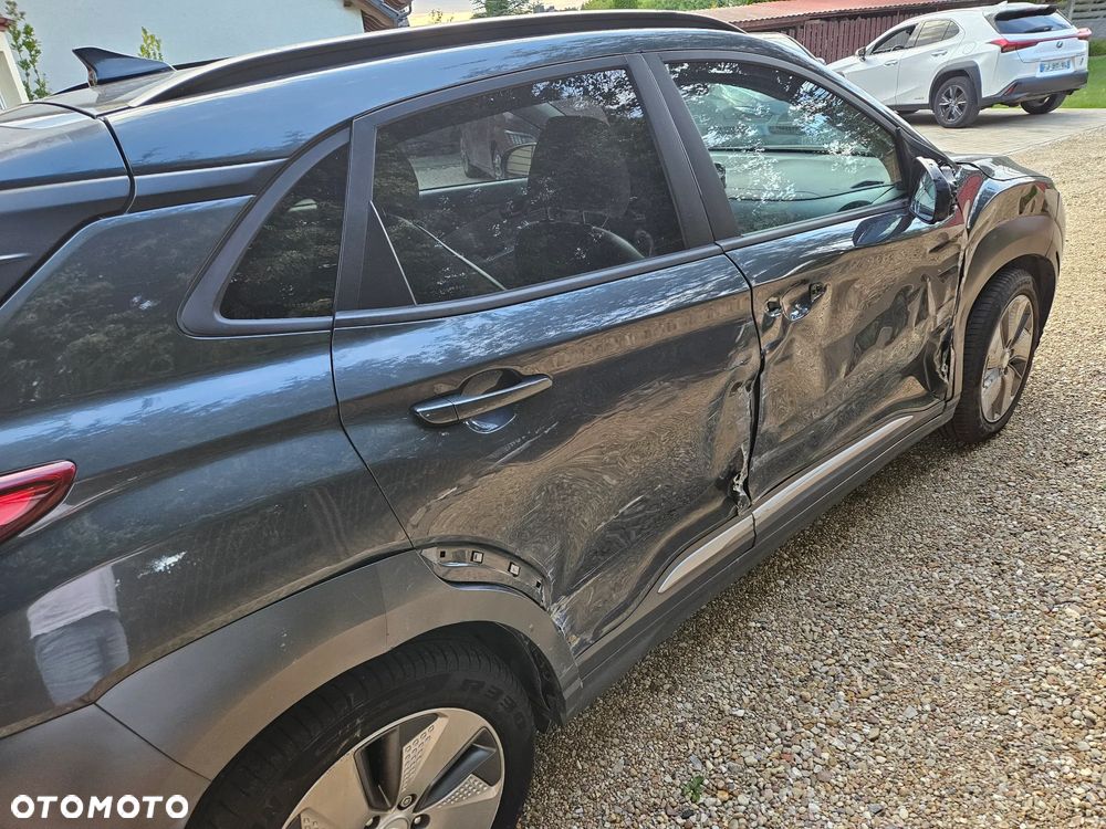 Hyundai Kona 64kWh Platinum - 3