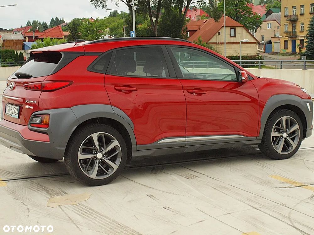Hyundai Kona 1.0 T-GDI EDITION 30 - 13