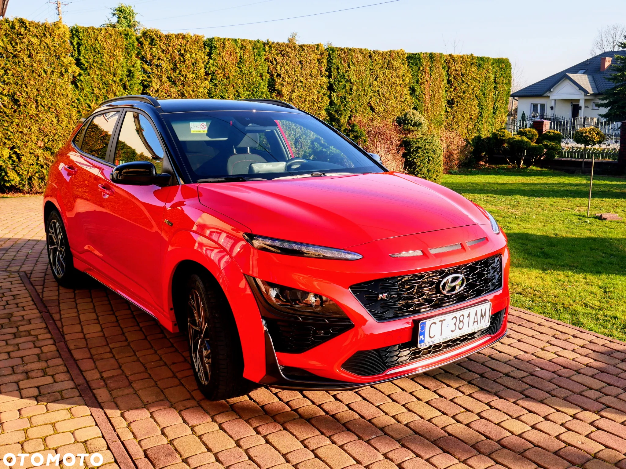 Hyundai Kona 1.6 T-GDI N Line DCT - 3