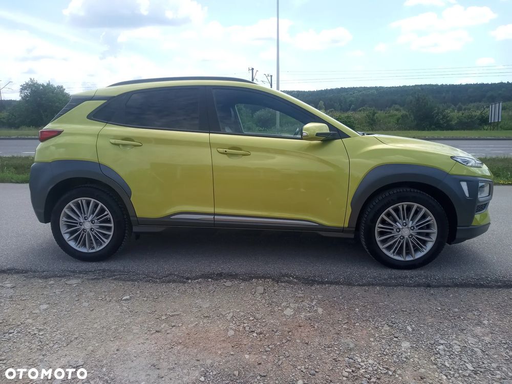 Hyundai Kona 1.6 CRDi DCT 4WD Premium - 7