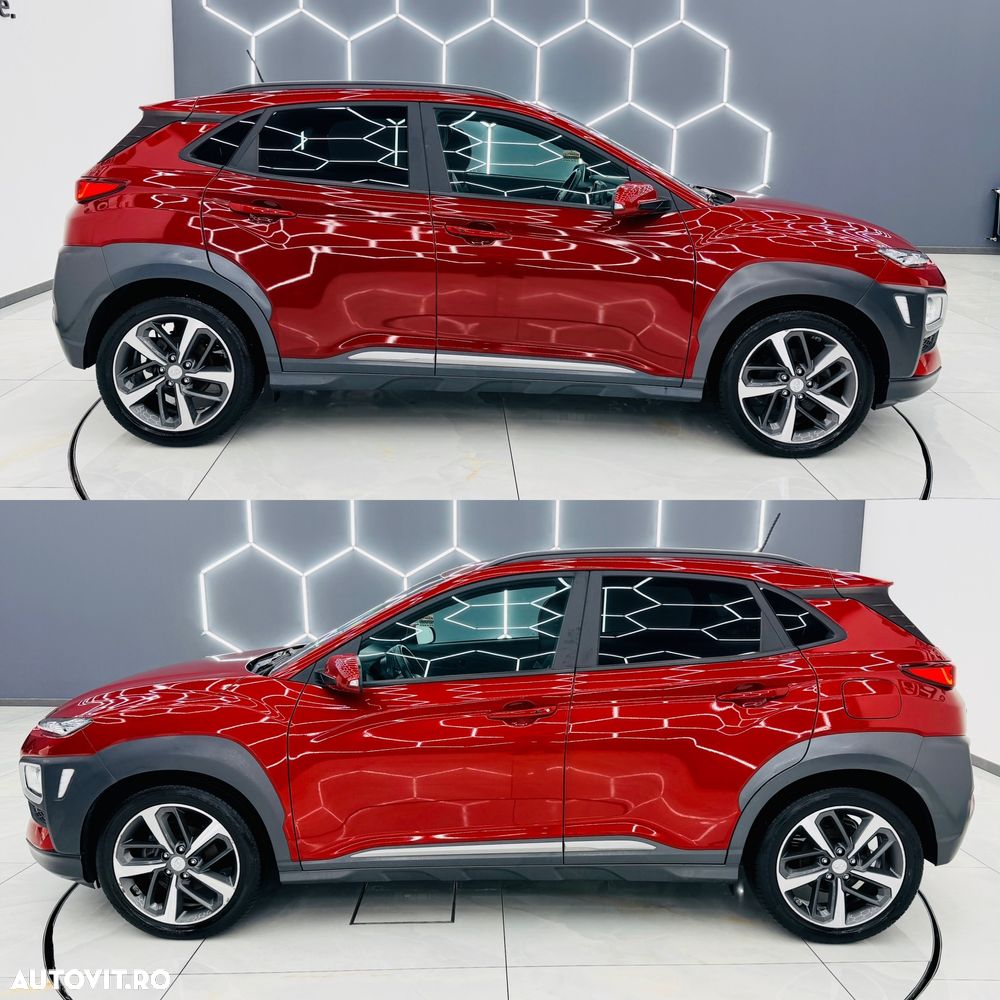 Hyundai KONA 1.0 T-GDI Premium - 5