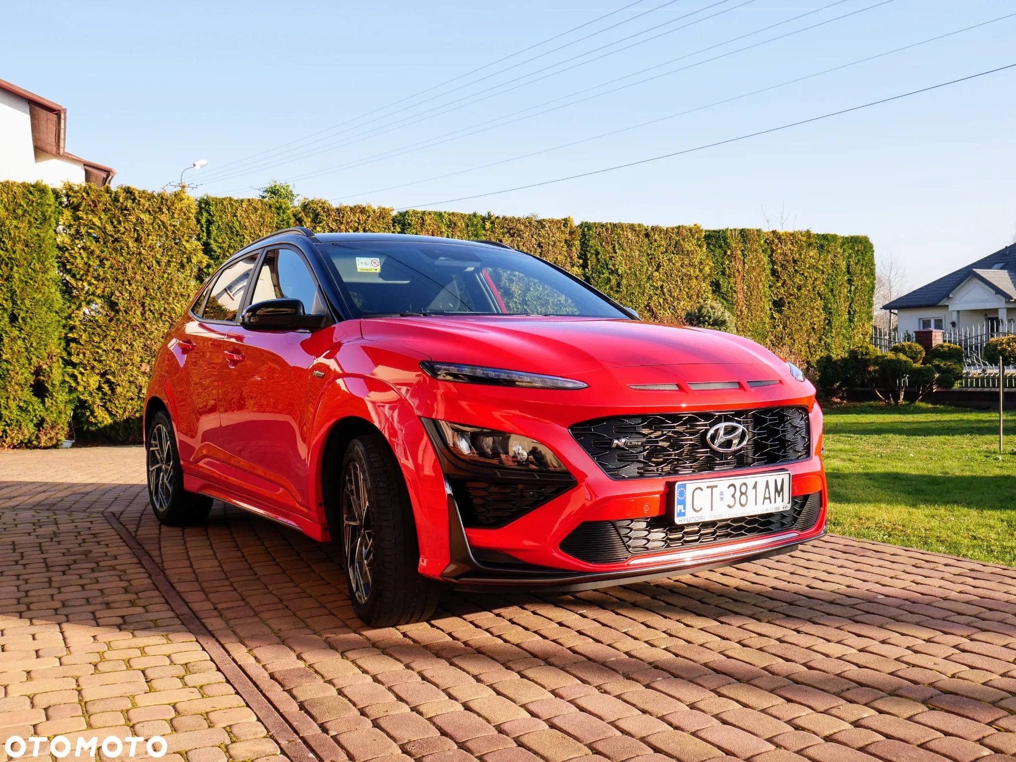 Hyundai Kona 1.6 T-GDI N Line DCT - 1