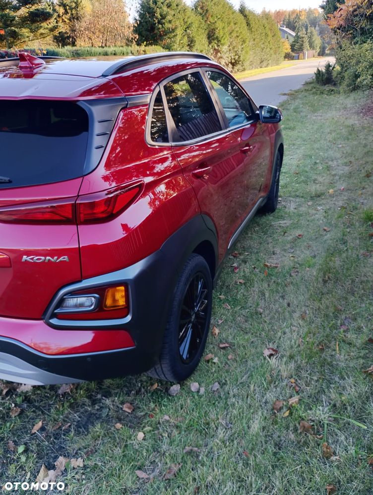 Hyundai Kona 2018 photo 5