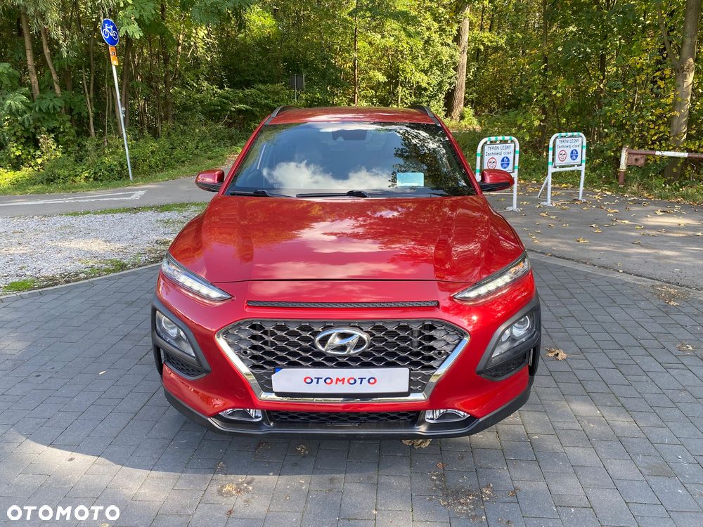Hyundai Kona 1.6 CRDi Style DCT - 2