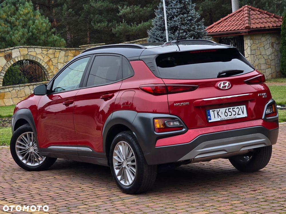 Hyundai Kona 2018 photo 4
