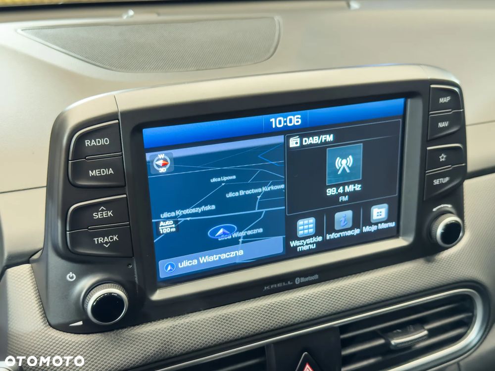 Hyundai Kona 1.6 CRDi Select - 35