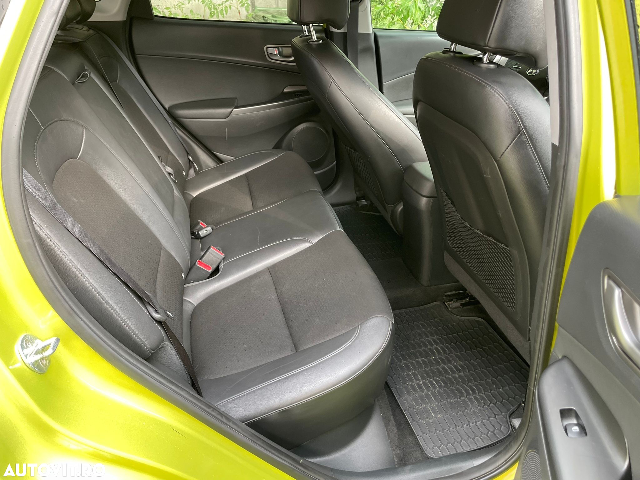 Hyundai KONA Electric 204CP Luxury+ - 15
