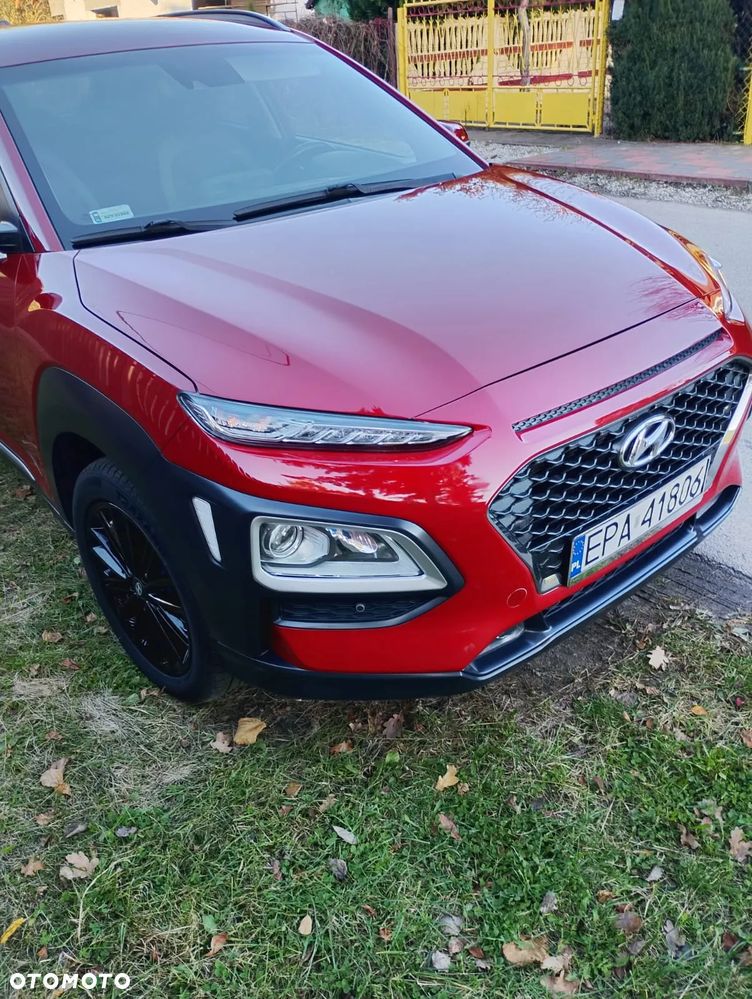 Hyundai Kona 2018 photo 2