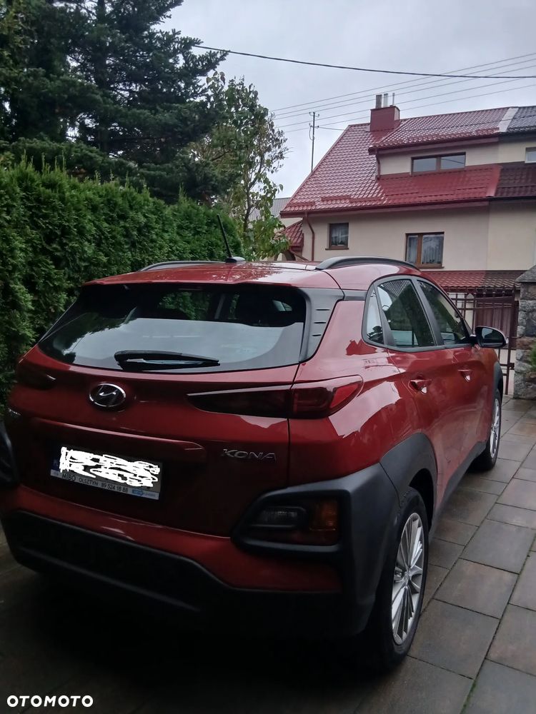 Hyundai Kona 2018 photo 4