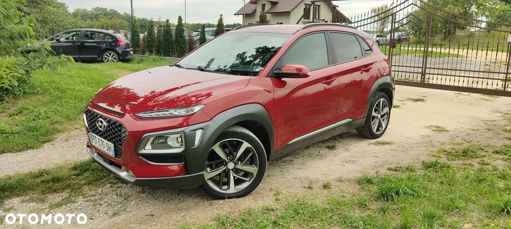 Hyundai Kona 1.6 CRDi DCT Premium - 2