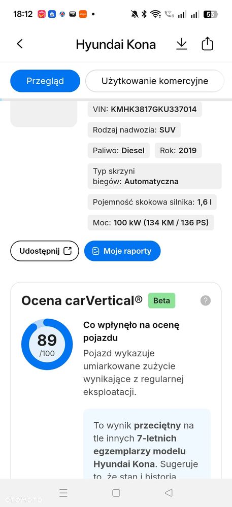 Hyundai Kona 1.6 CRDi DCT Premium - 35