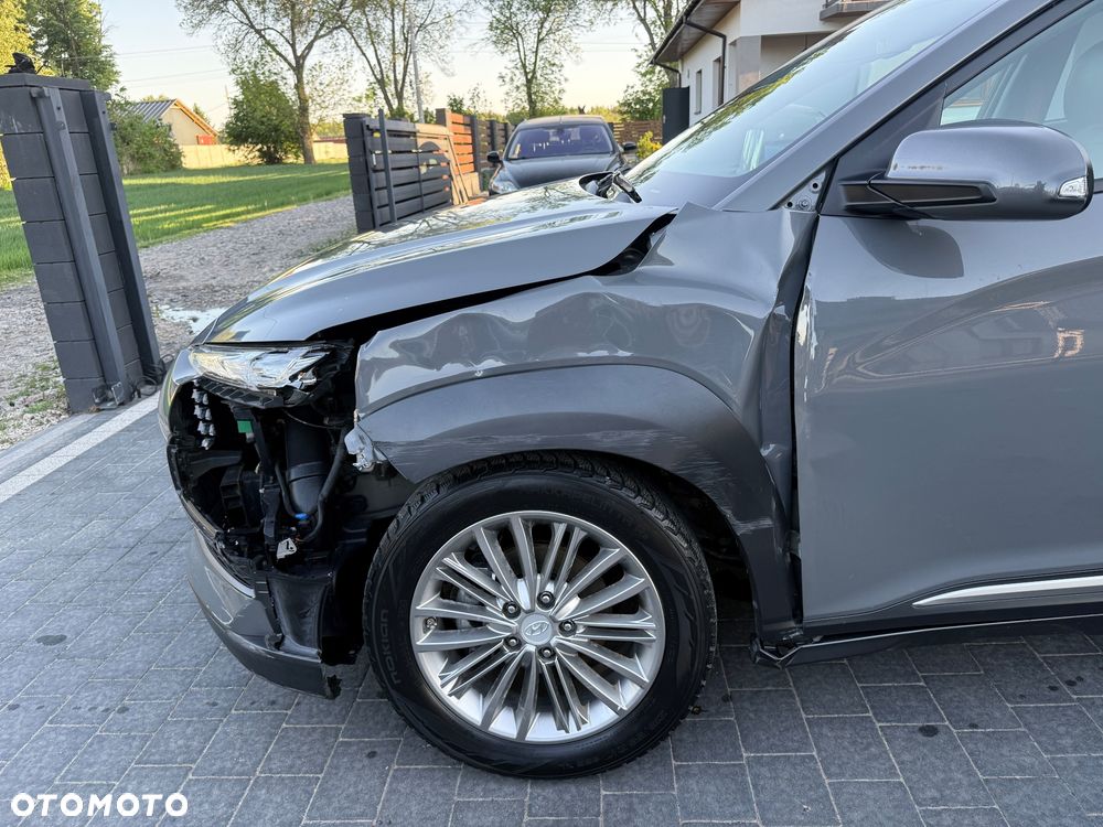 Hyundai Kona 1.6 CRDi DCT Premium - 7