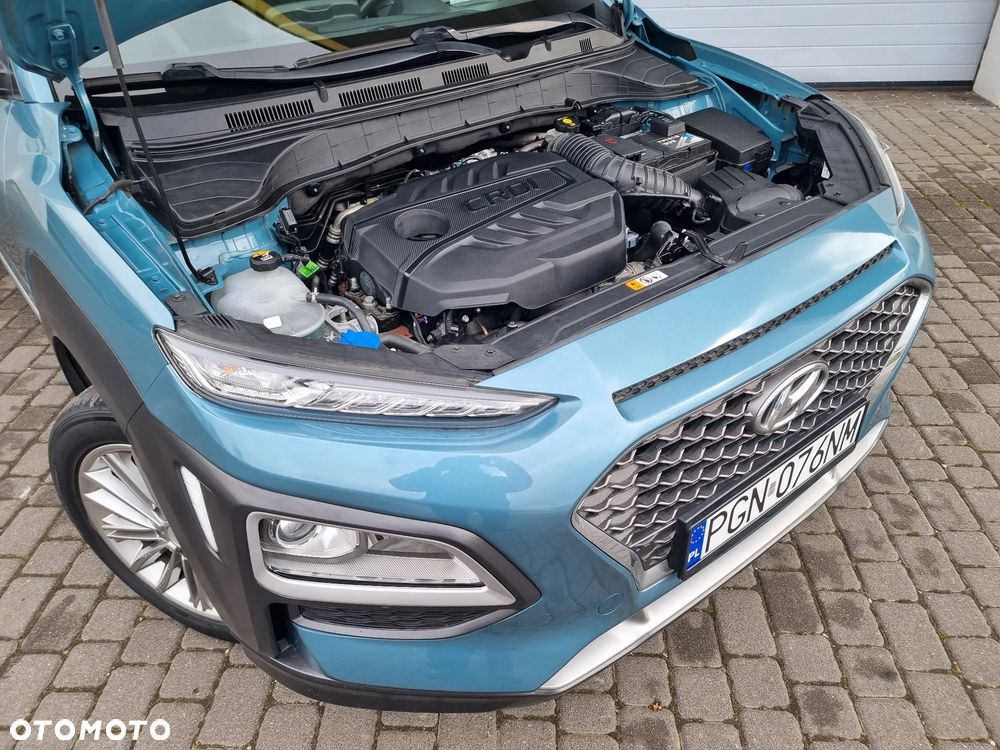 Hyundai Kona - 35