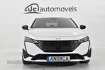 Peugeot 308 1.5 BlueHDi Allure Pack - 5