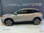 Peugeot 3008 1.6 BlueHDi Allure - 5