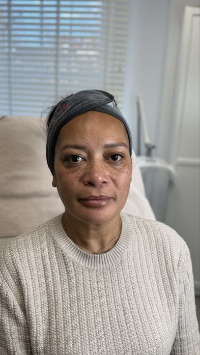 Міофасціальний масаж обличчя