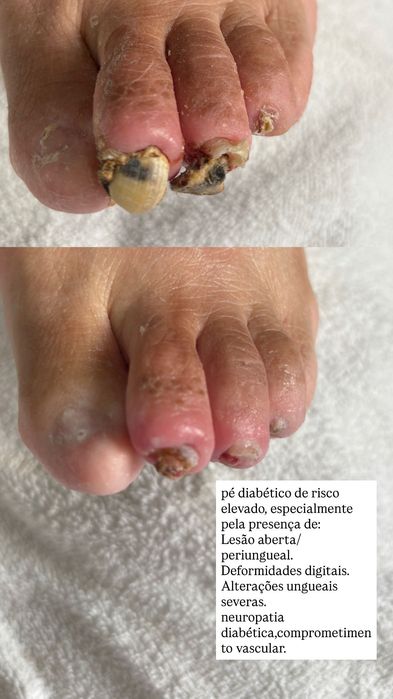 Podóloga cuidado e saúde dos pés