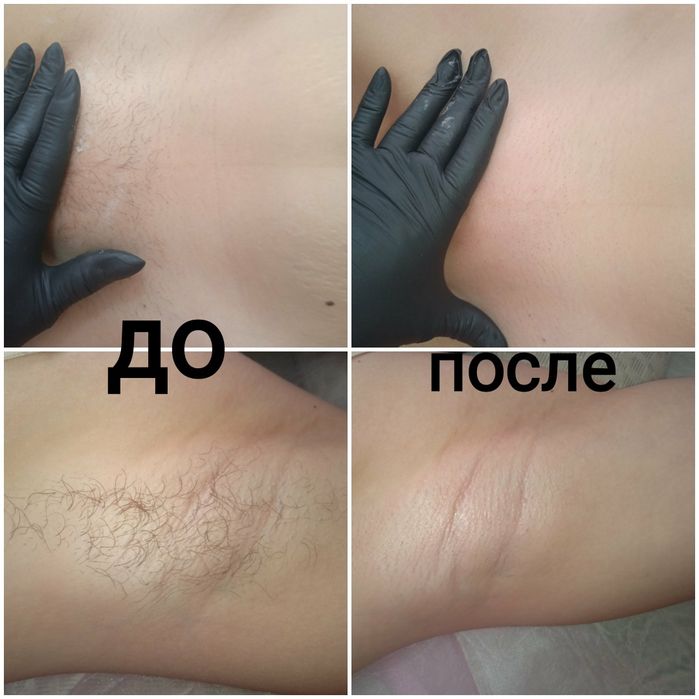 Шугаринг/ навчання/ курси/ депіляція