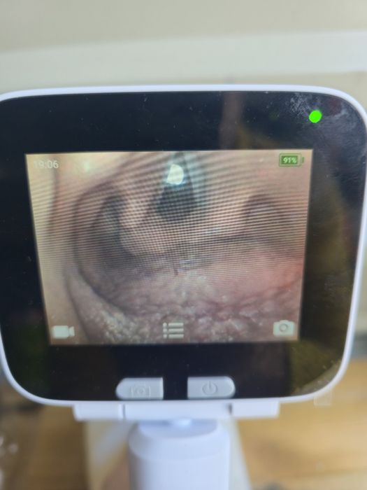 SIMEDU trenażer fantom do nauki intubacji dotchawiczej z zębami