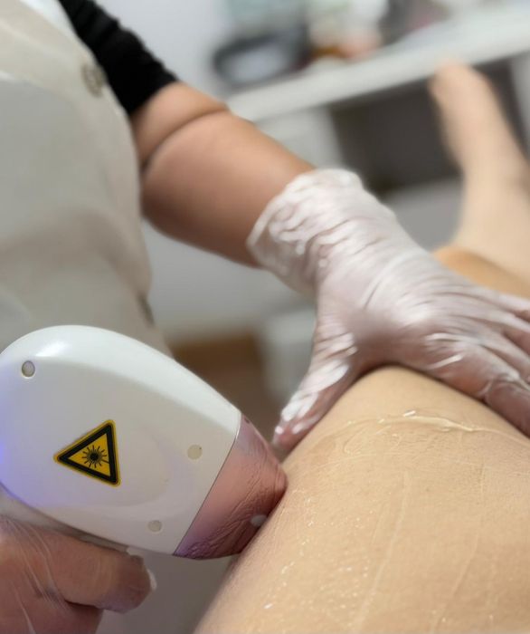 Depilação a laser