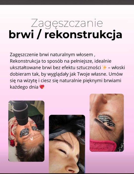 Rekonstrukcja brwi naturalnym włosem metoda Uv