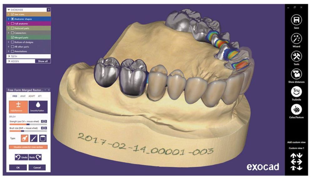 Exocad DentalCAD Implant Lab Bundle • Оригінальна ліцензія
