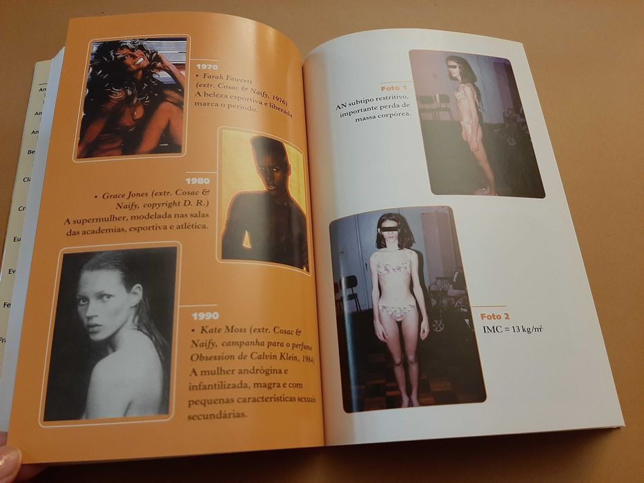 Anorexia, Bulimia e Obesidade// Salvador de Rosis Busse