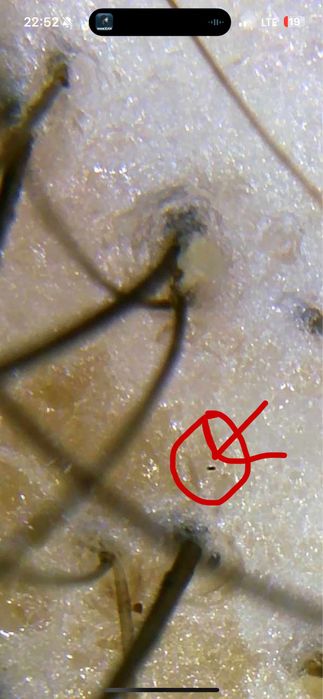 Трихоскоп Микроскоп ДерматоскопWiFi usb для телефона кожи головы волос