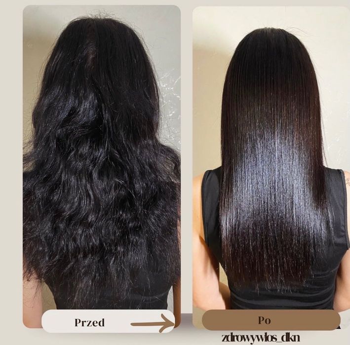 Nanoplastia , Botox , Rekonstrukcja , Regeneracja włosów