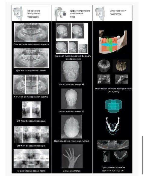 Комп'ютерний томограф Carestream CS9000