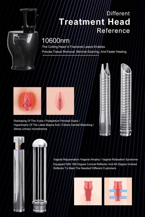 Laser Fracionado de CO2 para remoção de tatuagens e peeling facial