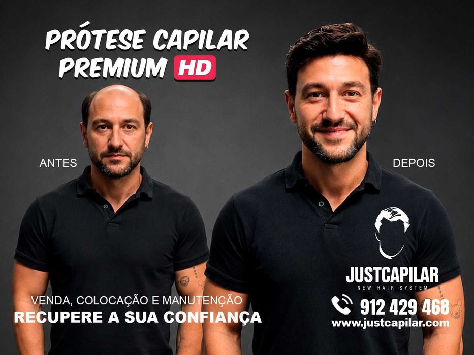Prótese Capilar HD Front Lace,  Clínica Justcapilar Lisboa e Aveiro. IVA Incluído.