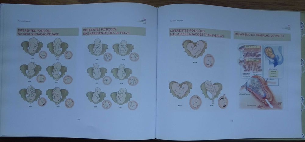 Nós A Gravidez e O Trabalho de Parto