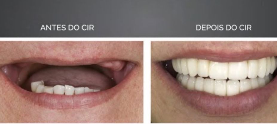 Sorriso brilhante e confiante sem dor de ouvido