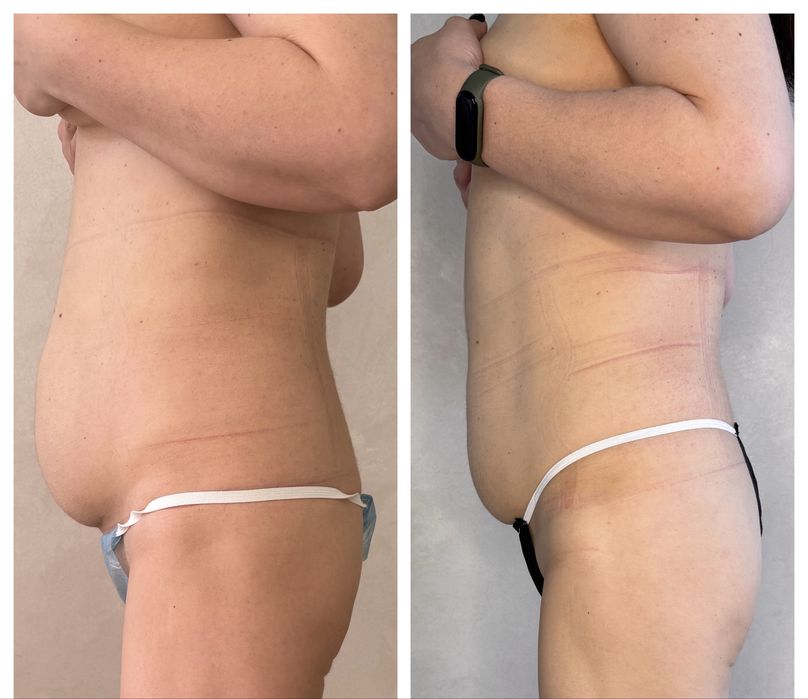 Массаж/ коррекция фигуры/ лазерная эпиляция/поселок Котовского