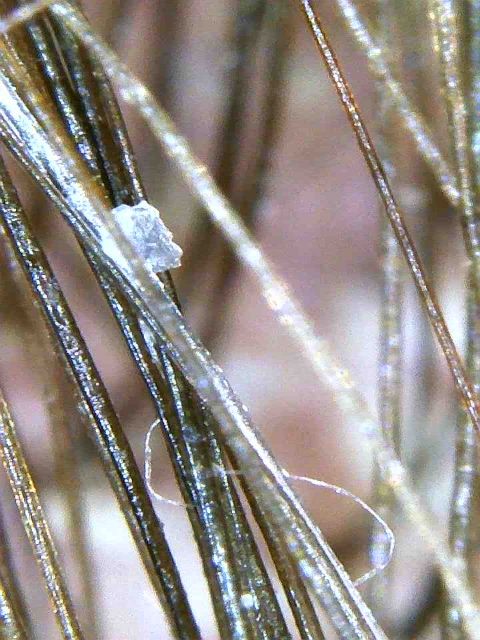 Трихоскоп Микроскоп ДерматоскопWiFi usb для телефона кожи головы волос