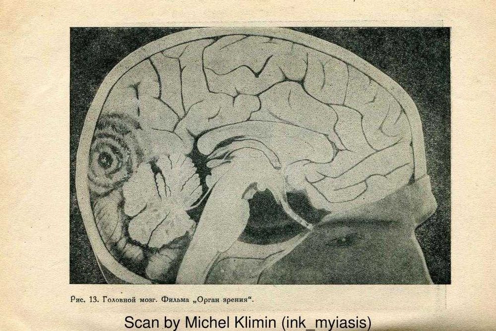 Патокинография в психиатрии и невропатологии | Сухаребский Лазарь 1936